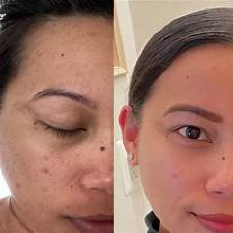 ميديكيوب - أمبولات فيتامين سي لتحسين لون البشرة 30...