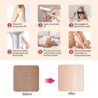 آلة إزالة الشعر من Lescolton 2in1 IPL آلة عرض LCD...