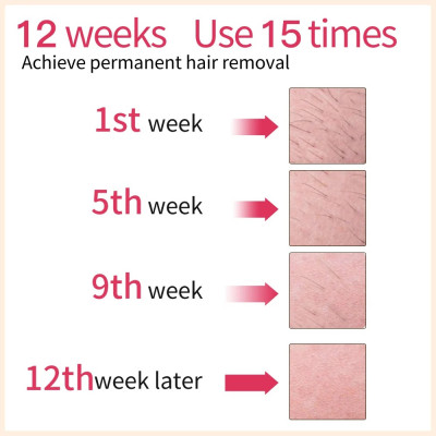 آلة إزالة الشعر من Lescolton 2in1 IPL آلة عرض LCD...