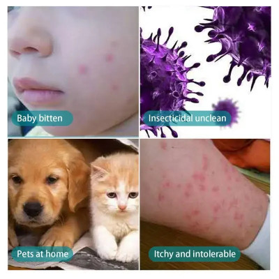 30 مللي علاج قمل البراغيث الحيوانات الأليفة رذاذ س...