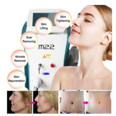 M22 2-in-1 M22 NG YAG إزالة الوشم بالليزر وإزالة آ...